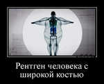Демотиватор Рентген человека с широкой костью 